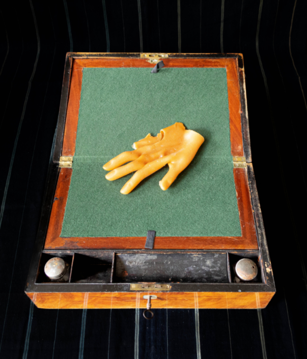 De Ex Voto, 33 gram of de ontbrekende pink